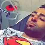 بالصور.. الاعتداء على مصري بالخناجر في السعودية
